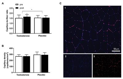 Enhanced Skeletal Muscle Oxidative Capacity and Capillary-to-Fiber Ratio Following Moderately Increased Testosterone Exposure in Young Healthy Women